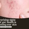 7 Signs Your Gut Is Damaging Your Skin