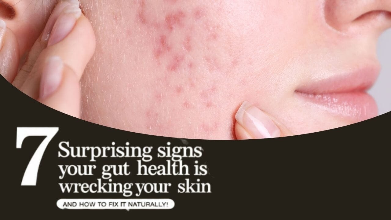 7 Signs Your Gut Is Damaging Your Skin